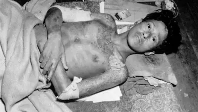 80 yıl sonra Nagasaki’den çağrı: Nükleer felaket kapıda