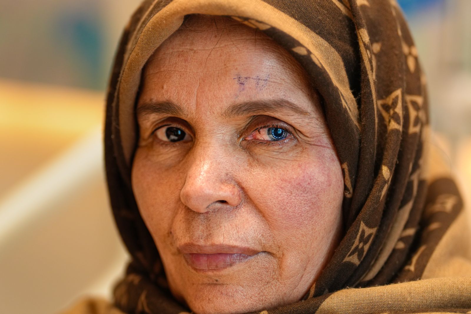 ''Artık göremezsin'' dedikleri Libyalı Kadın şifayı Türkiye’de buldu