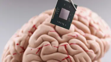 Elon Musk paylaştı: Beyin çipi takılan hasta düşünce gücüyle satranç oynadı