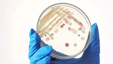 ABD'de "et yiyen bakteri" alarmı: 2025'te 9 kişi öldü