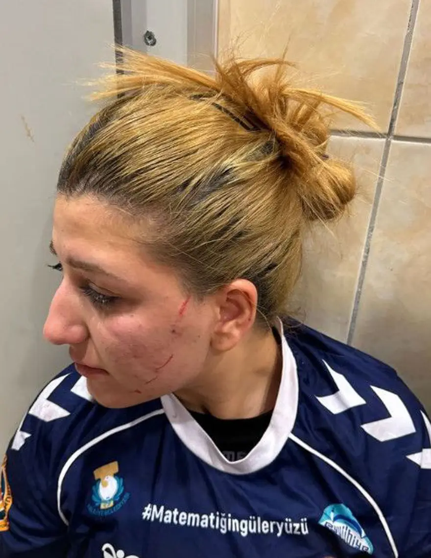 Tur atladılar dayak yediler: Güneşin Çocukları Hentbol Takımı'na çirkin saldırı 2