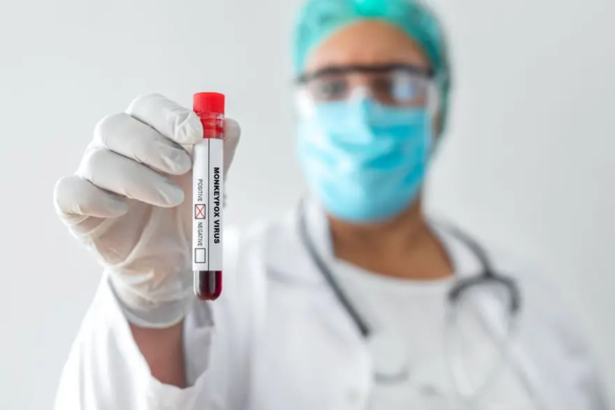 3) MAYMUN ÇİÇEĞİ BELİRTİLERİ NELERDİR? 4