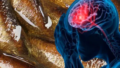 Hafızayı geliştiren 5 güçlü besin: Beyin sağlığı için her gün tüketilmesi gerekiyor