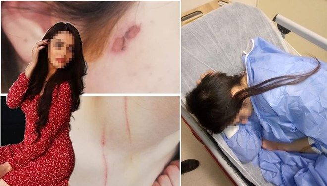 Rezidansta genç kıza işkence: 31'er yıla kadar hapis istemi