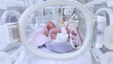 Doğuştan bağırsağının bir kısmı yoktu: 3 binde 1 görülen hastalıkla doğan bebek