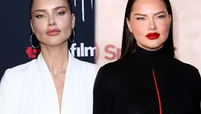Adriana Lima'nın son hali şaşırttı: Dolgularını mı eritti?