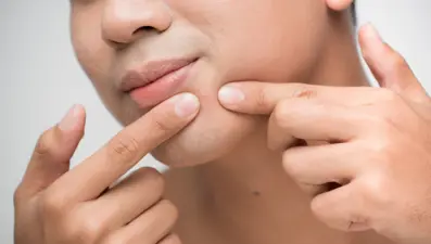 Sivilce sıkmak felce neden olur mu?