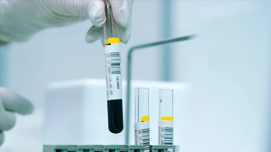 KAN BAĞIŞI YAPANLAR ORUÇ TUTABİLİR Mİ? 