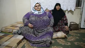 Yaşı 20, kilosu 350 (Obezite tedavisi görmek istiyor)