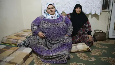 Yaşı 20, kilosu 350 (Obezite tedavisi görmek istiyor)