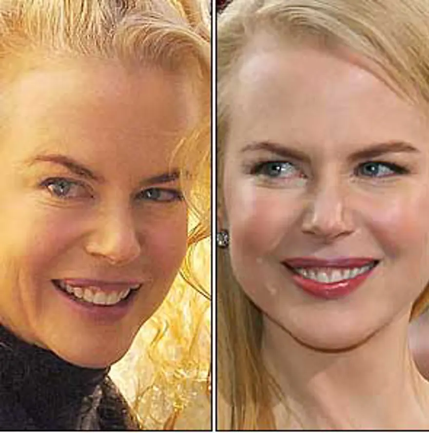 Nicole Kidman 6