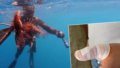 Ölüzannedip dokundu, parmağı bir anda şişmeye başladı: “Ağzındaki dikenler elime saplandı,çok değişik bir acı hissettim”