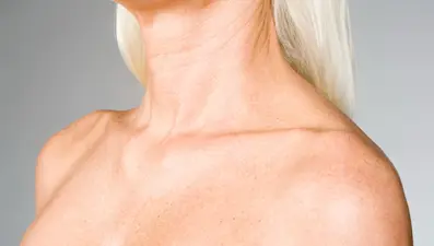 Boyundaki kırışıklıklar nasıl önlenir? 40'lı yaşlarınıza girmeden önce boyun çizgilerini yok edin