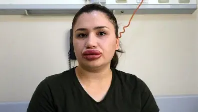 Sağlık Bakanlığından sahte estetikçilere sıkı takip