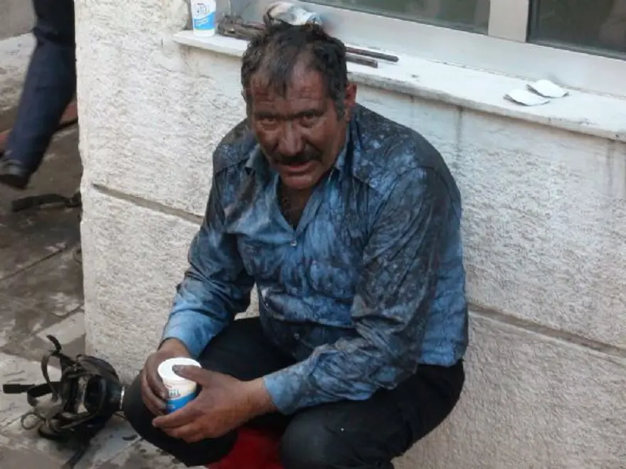 Gözünü kırpmadan ateşe daldı 6 Gözünü kırpmadan ateşe daldı 6