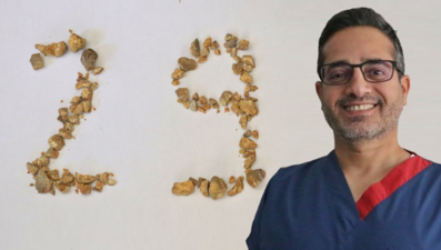 Profesörünilginç kutlaması: Böbrek taşlarıyla 29 Ekim kutlaması yaptı