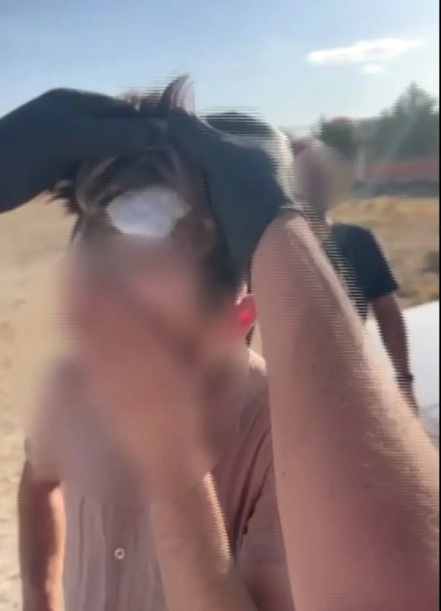 Polis şişlikten şüphelendi, peruğun altındanuyuşturucu çıktı 2