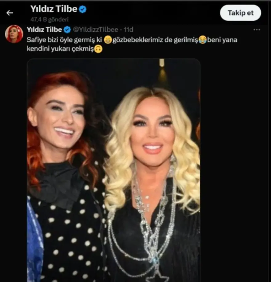 Safiye Soyman filtreyi abarttı, Yıldız Tilbe'den tepki gecikmedi: Göz bebeklerimizi bile germişsin Safiye 2 Safiye Soyman filtreyi abarttı, Yıldız Tilbe'den tepki gecikmedi: Göz bebeklerimizi bile germişsin Safiye 2