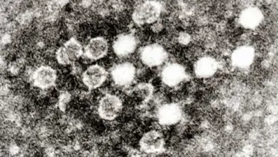 ABD’de parvovirüs vakalarında büyük artış