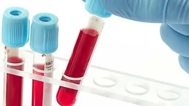 Uzmanlar uyarıyor: 0 grubuyum diye corona virüs tedbirlerini bırakmayın