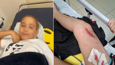 Okul bahçesinde bayrak direği öğrencilerin üzerine devrildi