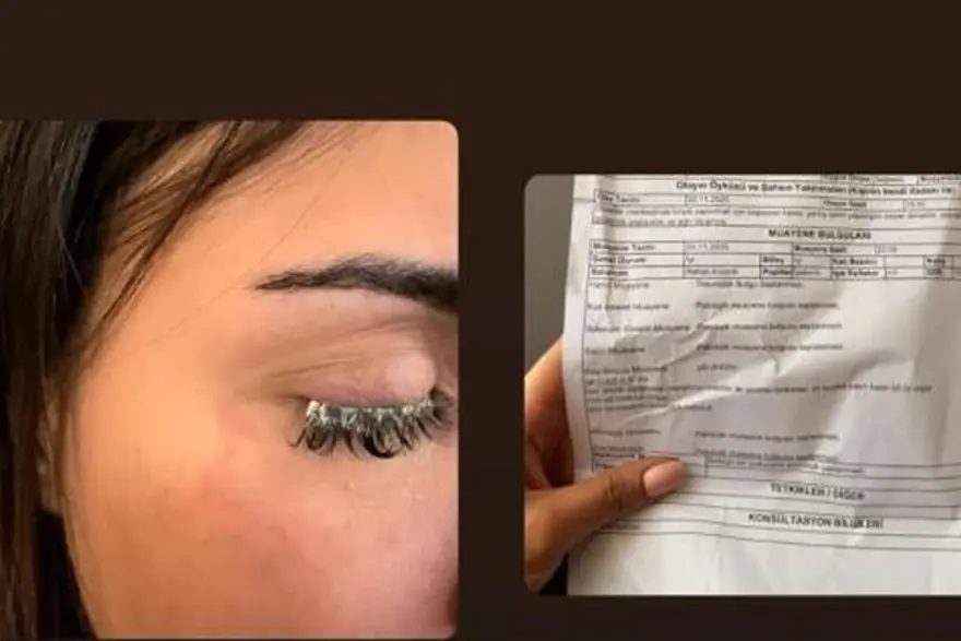 Kirpiklerini yaptırmaya gitti, gözüne yapıştırıcı kaçtı! "Gözlerim göremez hale geldi" 