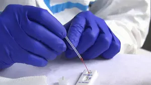FDA’dan dakikalar içinde sonuç veren ilk corona virüs antijen testine onay