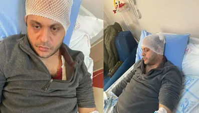 Gaziantep'te hasta yakınından doktora mermerli saldırı