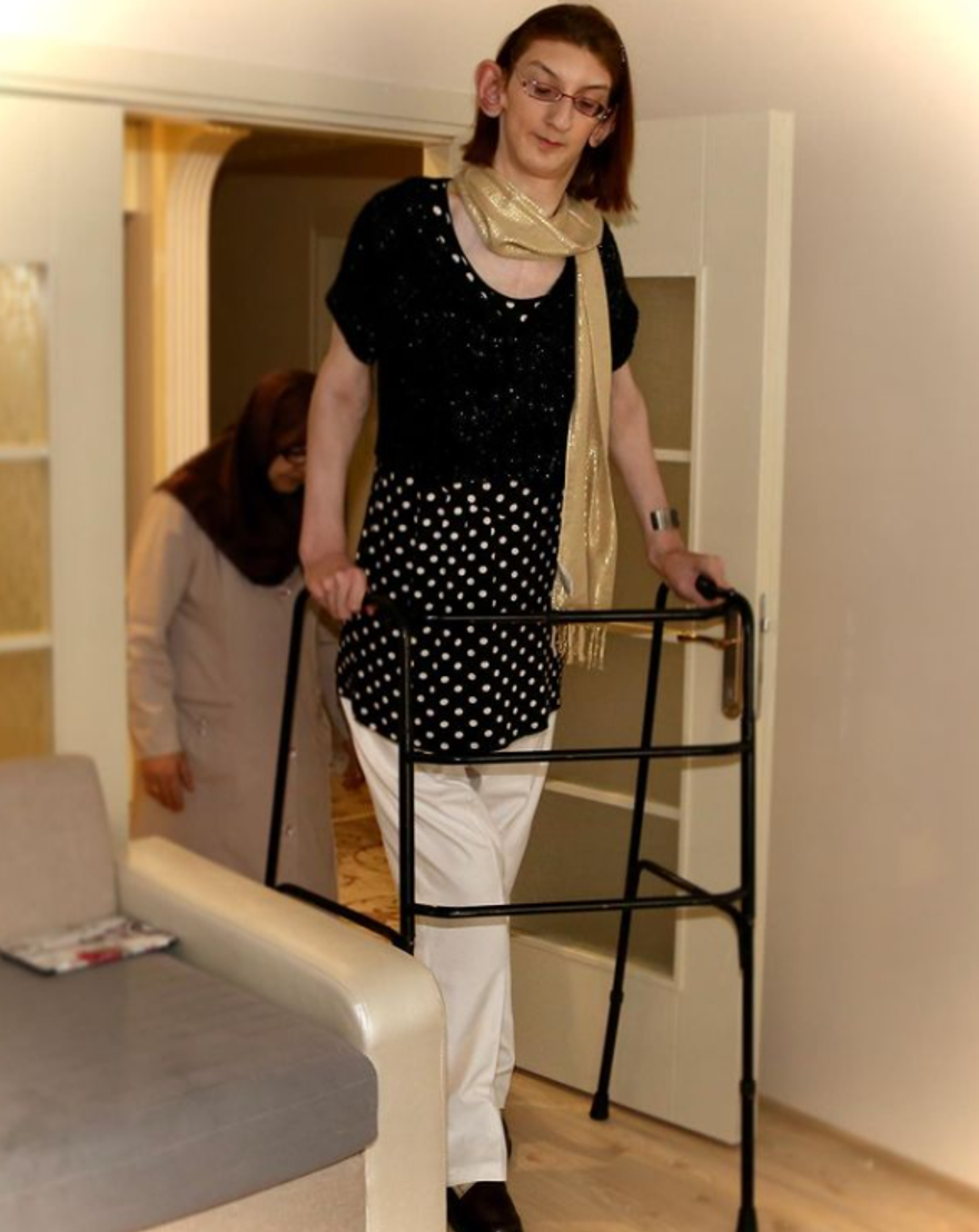 Dünyanın en uzun boylu kadını Rümeysa Gelgi, Guinness Rekorlar Kitabı'na girdi 10 Dünyanın en uzun boylu kadını Rümeysa Gelgi, Guinness Rekorlar Kitabı'na girdi 10