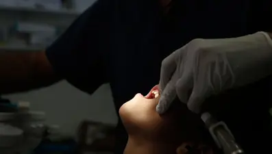 Sahte dişçi skandalı: Yapıştırıcıyla sahte kaplama yaptı, insanlar dişlerini kaybetti