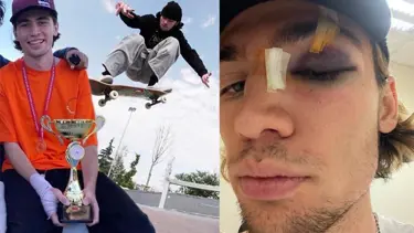 İstanbul'da milli sporcuya dayak