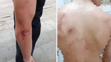 14 yaşındaki çocuğa öldüresiye dayak