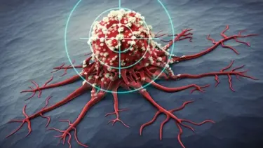 Prostat kanseriyle mücadele eden 6 besin: Bilim insanları kanıtladı