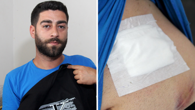 Karnında ağrı hissetti, gerçek röntgende ortaya çıktı