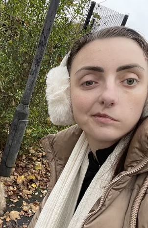 Dünyada nadir görülen hastalığa yakalandı: Göz seyirmesi ilk belirtisiymiş, yüzünün yarısı felç kaldı