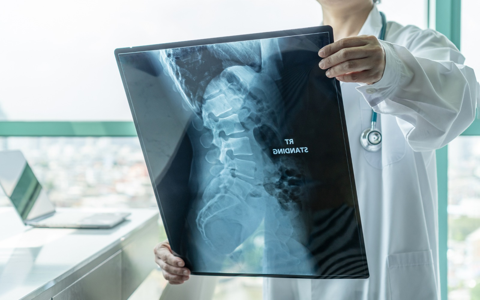 Ankilozan spondilit nedir? Ankilozan spondilit belirtileri ve ankilozan spondilit tedavisi nelerdir?