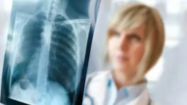 Kronik akciğer hastalarına bahar uyarısı