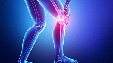 Veganların kemikleri vegan olmayanlara göre daha zayıf