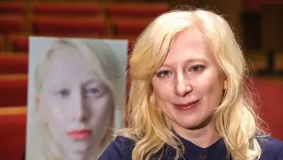 Albinizmi "Kar Taneleri"yle anlattı, uluslararası festivalde ödül aldı