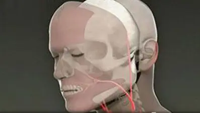 Yüz nakli için beyin ölümü sonrası bağış çok önemli