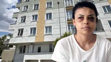 Düğünde maganda dehşeti: Saçmalar gözüne isabet etti