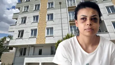 Düğünde maganda dehşeti: Saçmalar gözüne isabet etti