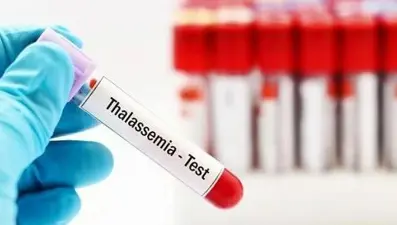 Akdeniz anemisi (Talesemi) nedir? (Akdeniz anemisi belirtileri ve tedavi yöntemleri)