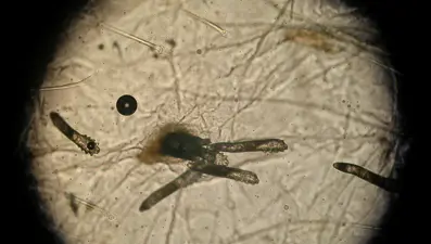 Uyurken yüzümüzde çiftleşiyorlar: Gece ortaya çıkan böcekler