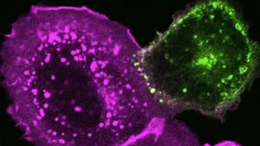 Corona virüs, hücreleri kolesterol sayesinde istila ediliyor