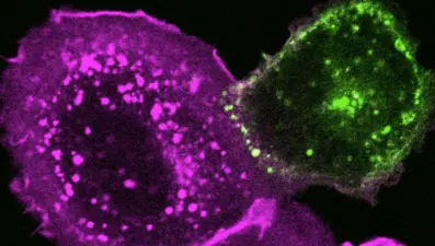 Corona virüs, hücreleri kolesterol sayesinde istila ediliyor