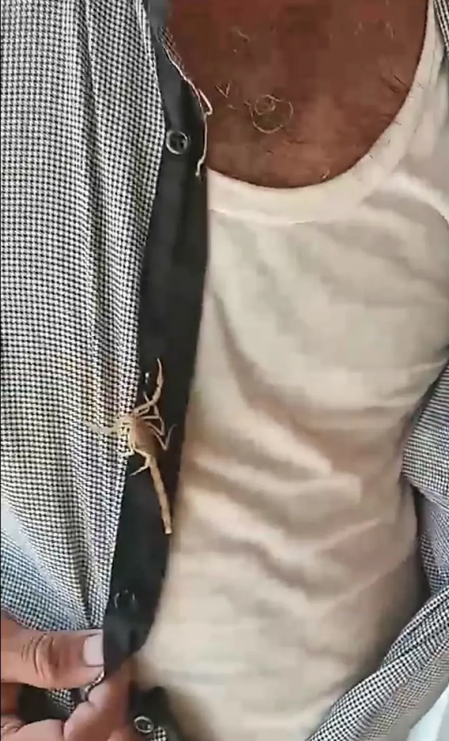 İki akrebi ağzına alıp kendini sokturdu 2