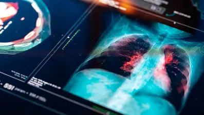 2007'den bu yana ilk: En öldürücü tür, 1 kişi hayatını kaybetti