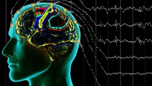 Epilepsinin kesin nedeni bilinmiyor (Epilepsiyi neler tetikler?)