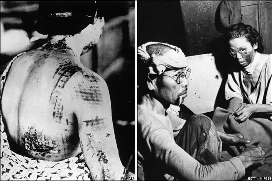 İnsanlığın kaybettiği yer: Hiroşima 37 İnsanlığın kaybettiği yer: Hiroşima 37